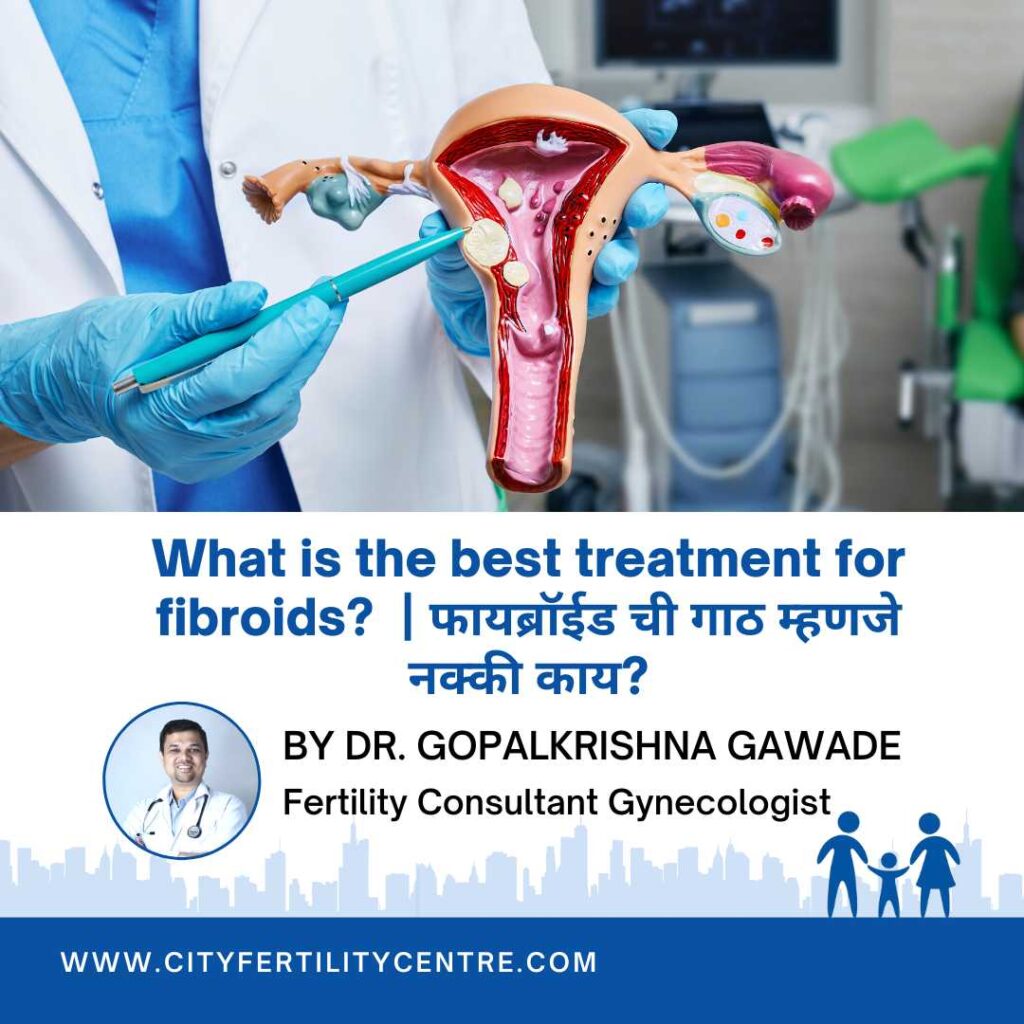 Fibroids, also called leiomyomas or myomas, are growths that appear in the uterus. They're noncancerous and extremely common. Fibroids treatment available at City Fertility Centre, Pune.