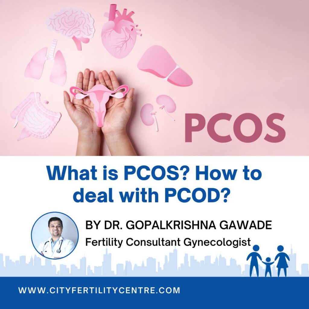 PCOS : Causes, symptoms & treatment options | Dr. Gopalkrishna Gawade