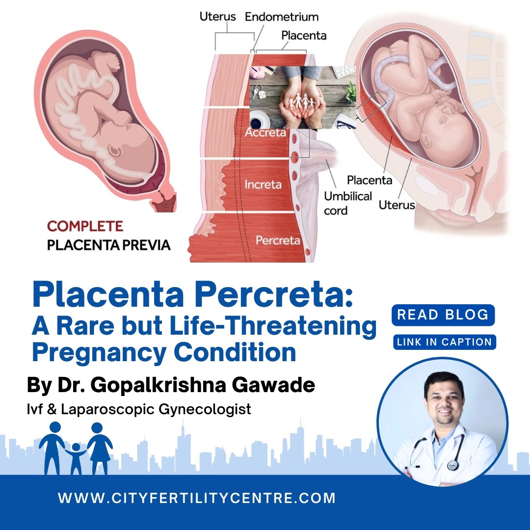 Placenta Percreta Treatment in Pune